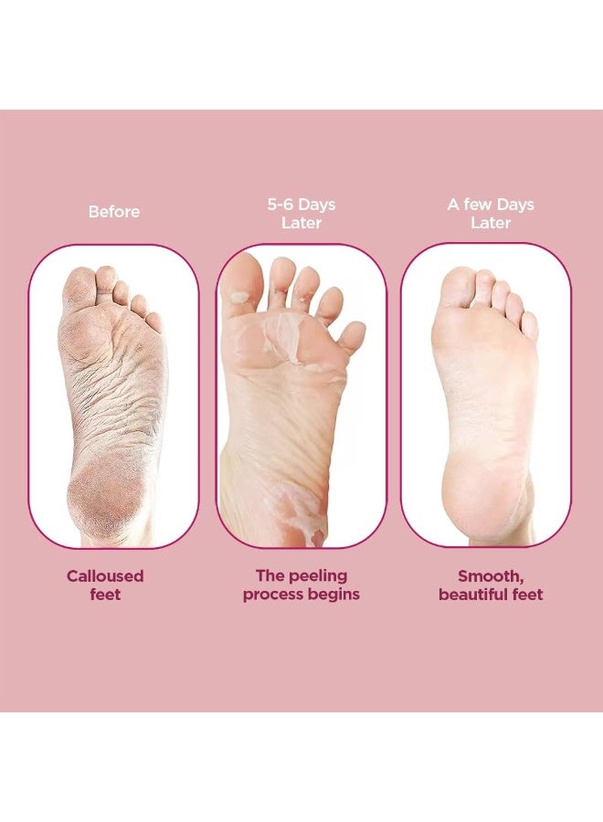 PEE SAFE FURR EXFLOATING FOOT PEEL MASK - Image 4