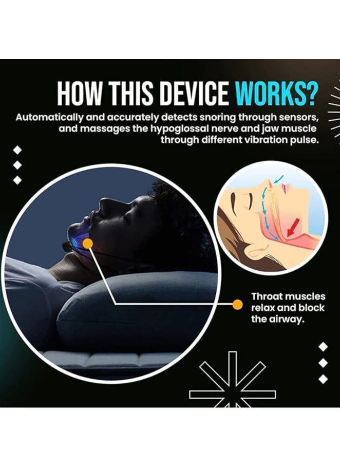 General - Non-snoring micro-device - Nap2slim Natural-Impulse Device, electric anti-snoring device, EMS intelligent anti-snoring device, improve sleep quality, relieve fatigue (1 piece) - Image 1