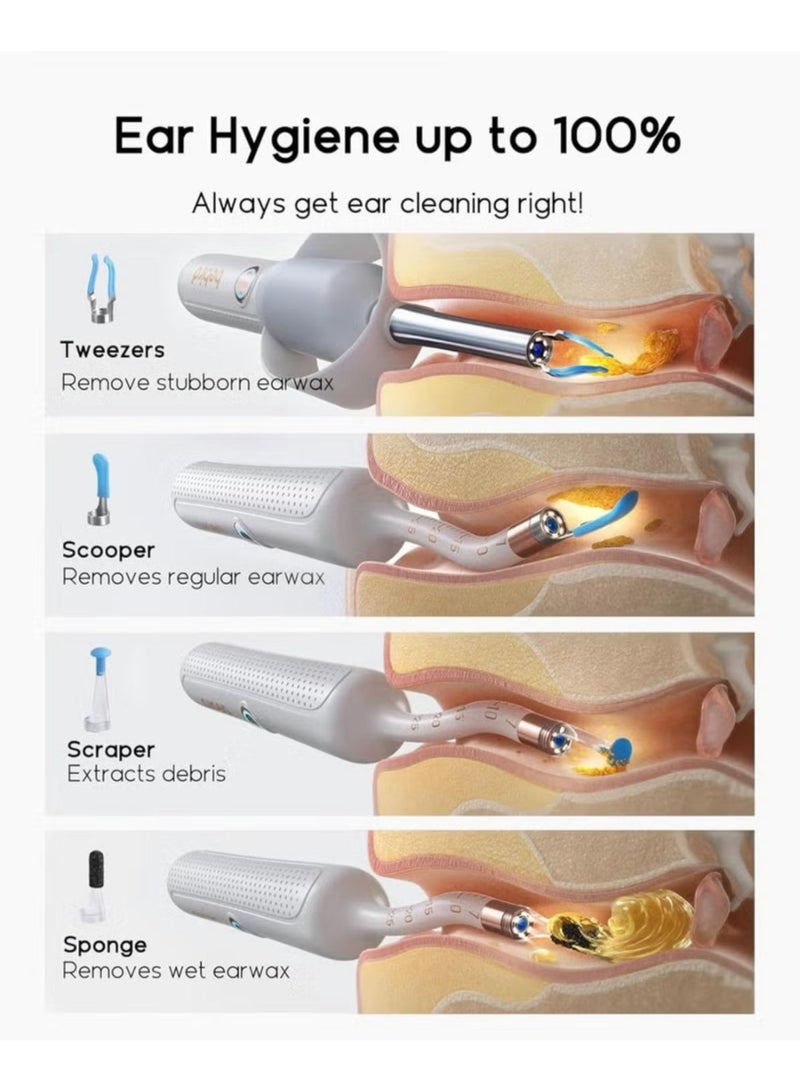 بيبيرد جهاز Bebird EarSight 3 Plus لتنظيف الأذن بصرياً، مزود بكاميرا عالية الدقة (HD) وإضاءة LED؛ طقم لاسلكي (عبر WiFi) لفحص الأذن وإزالة الشمع، يشتمل على أدوات متعددة الوظائف (ملاعق ومجسات وملقط) ومناسب لجميع أفراد الأسرة - اللون الأبيض. - Image 3