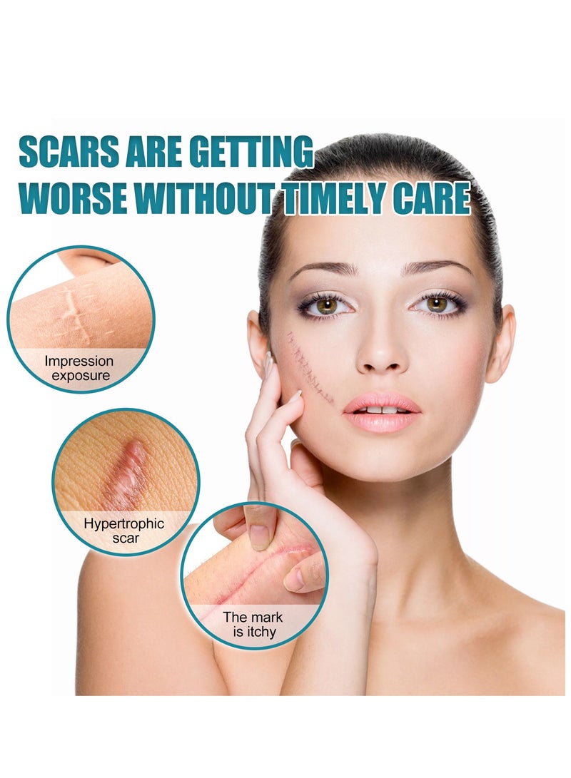 West&Month Silicone Scar Sheets, Scar Patch, Fade Scar Sticker, Efficient Beauty Scars Removal Cesarean Section Burn Scars Left Behind Gel Painless Tape Roll (4cm * 1.5m) - Image 4