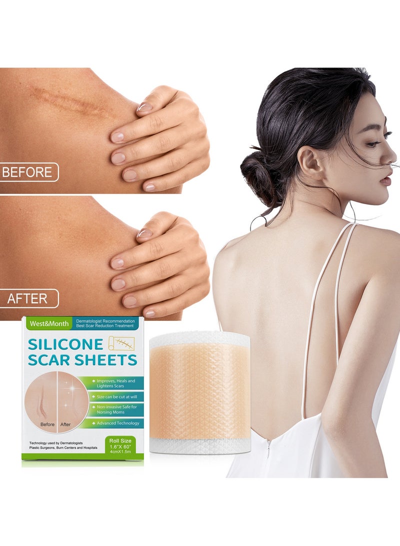 West&Month Silicone Scar Sheets, Scar Patch, Fade Scar Sticker, Efficient Beauty Scars Removal Cesarean Section Burn Scars Left Behind Gel Painless Tape Roll (4cm * 1.5m) - Image 5