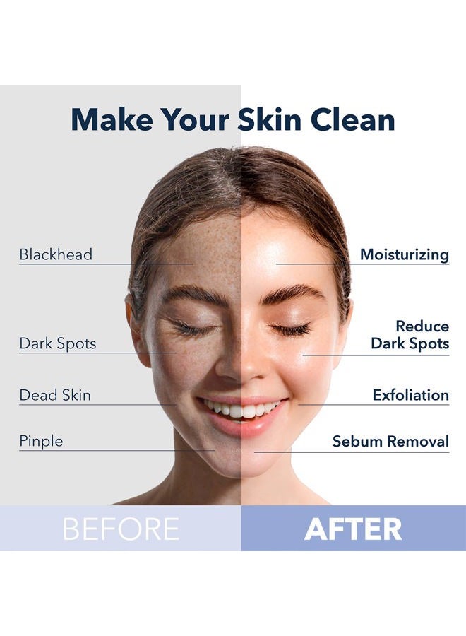 Purederm Deep Purifying Pink O2 Bubble Mask Peach (5 Pack) – Bubble Face Sheet Mask for Purifying & Moisturizing - Image 3