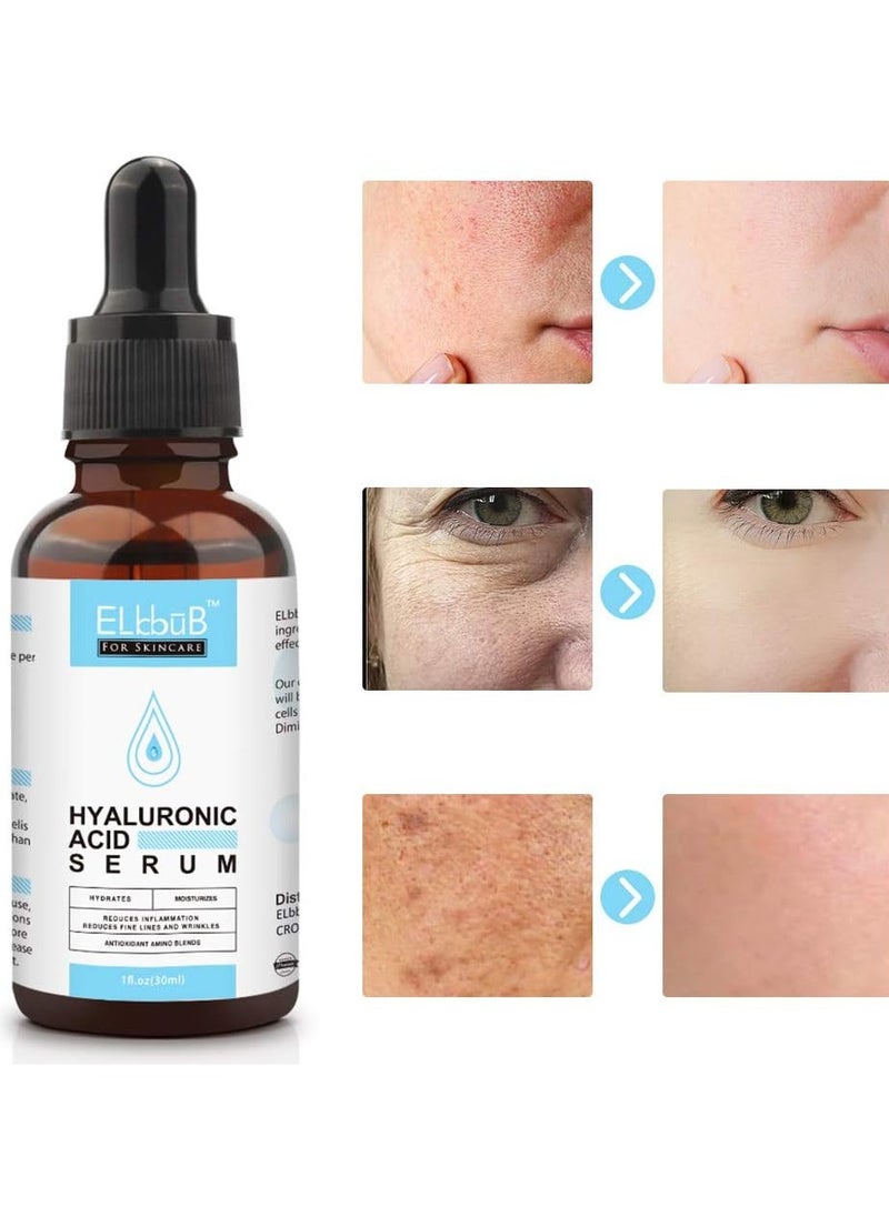 ELBBUB ELBBUB Hyaluronic Acid Serum 30ml – Anti-Aging & Moisturizing Serum for Fine Lines & Wrinkles, Soft Hydration, Easy Absorption, Skin Firming  - Image 1