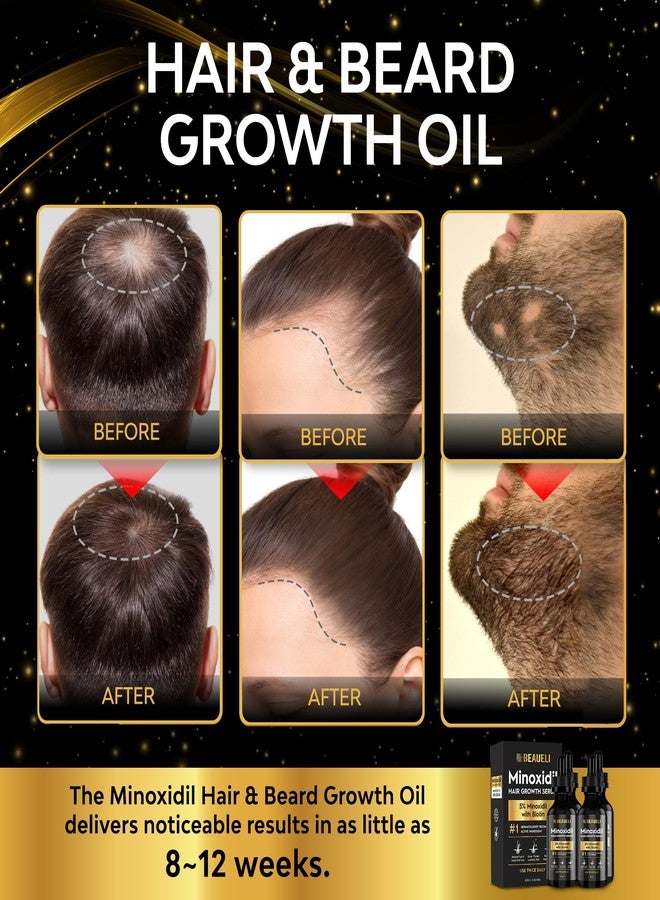 beaueli 5% Minoxidil Hair Growth Serum for Men and Women: Extra Strength Minoxidil Beard Regrowth Treatment Serum with Biotin for Thinning Hair Loss to Grow Thicker Fuller 8 FL OZ (4 Bottles) - Image 2