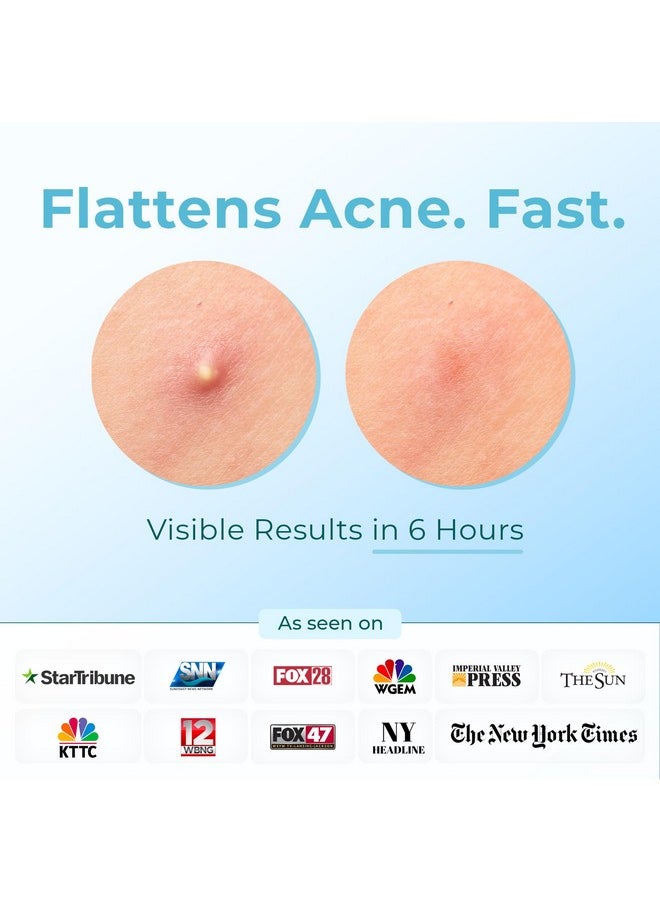 Cleof - Pimple Patches (Made In Korea) For Face & Body Overnight Treatment Acne Patch For Zits Bumps Spots Pimples Whiteheads Hydrocolloid Stickers Vegan Crueltyfree Hypoallergenic (12Mm) - Image 1