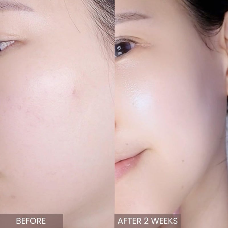 aplin Pink Tea Tree Intensive Cream - 50g/Skin Moisturizer/Facial Moisturizers/1.7 Oz, CICA, Allantoin, Korean Skin Care, Moisturizer, Hydrating - Image 2