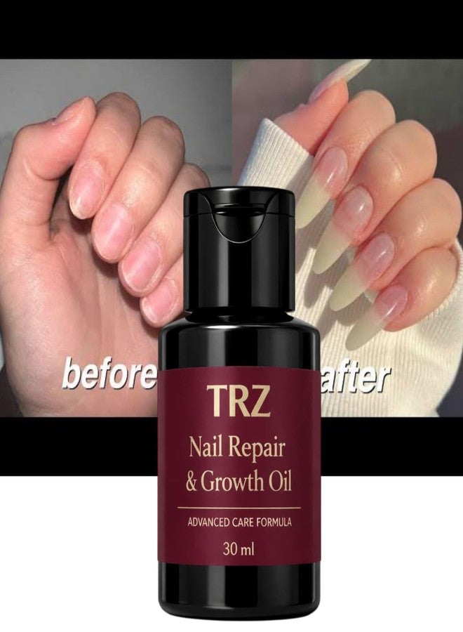 TRZ Nail Growth Oil | Best Nail Care Oil for Housewives | Strengthens Nails & Supports Nail Fungus Prevention - Image 4