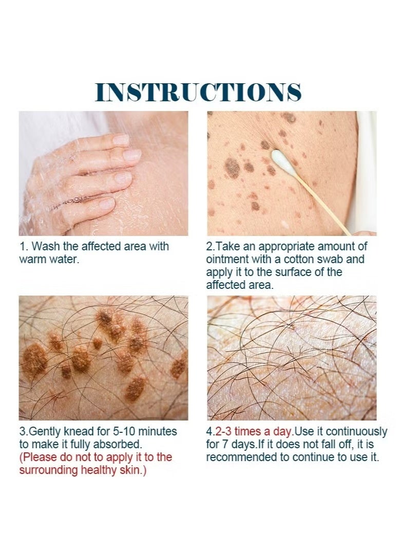 KanyeHB Wart Remover, Wart Remover Ointment, Wart Remover Freezer, Fast Acting Wart Remover Gel (Maximum Strength), Wart Remover Freezer, Wart Remover Cleansing Cream, Wart Remover Cream (20g) - Image 2