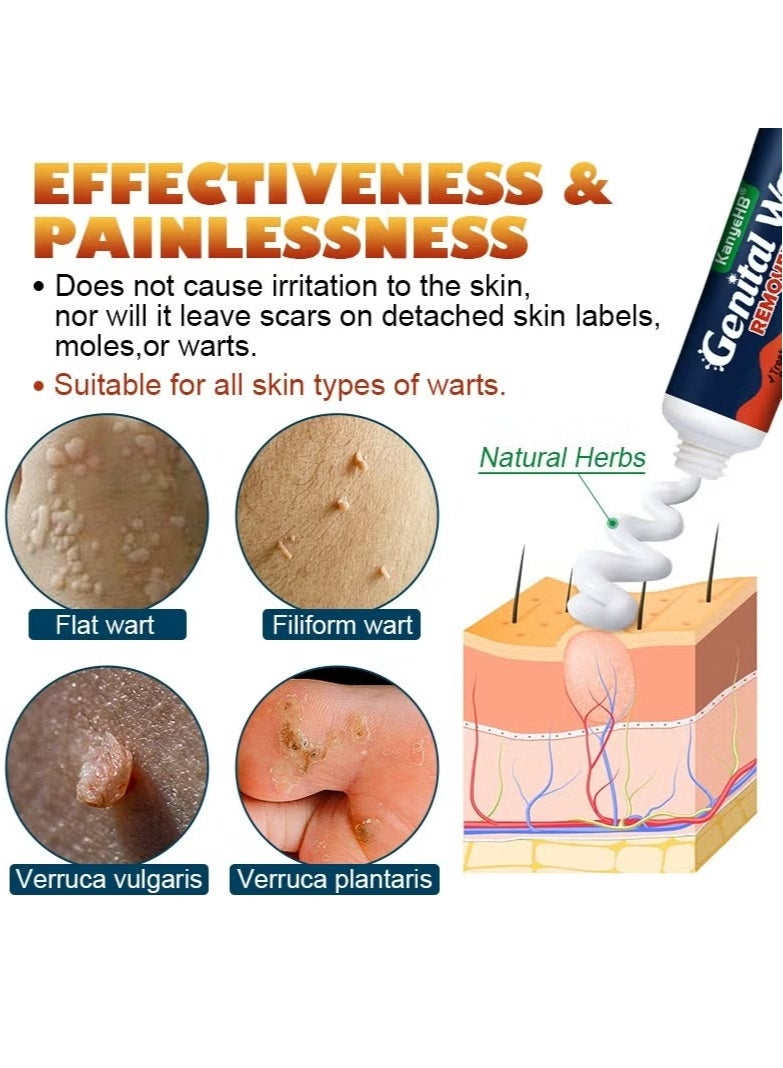 KanyeHB Wart Remover, Wart Remover Ointment, Wart Remover Freezer, Fast Acting Wart Remover Gel (Maximum Strength), Wart Remover Freezer, Wart Remover Cleansing Cream, Wart Remover Cream (20g) - Image 3