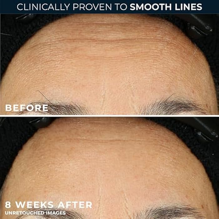 RoC Retinol Correxion Anti-Aging Wrinkle Night Serum, Retinol Serum for Face, Daily Treatment for Fine Lines, Post Acne Scars, 30 Capsules, Unscented, 0.35 Fl Oz - Image 4