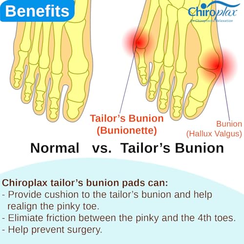 Chiroplax Tailor's Bunion Corrector Pads Bunionette Pain Relief Pinky Little Toe Straightener Separator Cushion Splint Protector Shield Spacer Cover Guard (4 Pads, Shims - Large) - Image 5