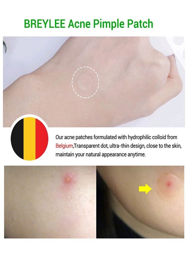 Breylee - 22 Piece Invisible Acne Treatment Pimple Patch Set Clear Daily Use - Image 1