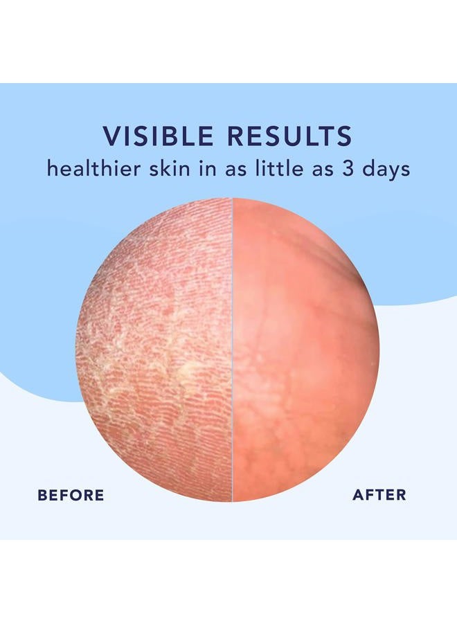 Barefoot Scientist HIGH DIVE - NEW - Intensive Hydration Therapy. Relieve Even the Driest Cracked Skin & Keep Feet Soft & Silky Smooth Year-Round. With 4 Types of Hyaluronic Acids & 5% Urea. - Image 3