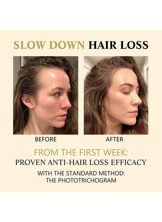 West&Month Hair Boost Darken Strengthen Essence Promote Hair Circulation Visibly Stronger And More Abundant Looking Hair,Scalp Massage Roller For Hair Loss Treatments, Aids against Hair-thining, Hair Regrowth Tr  - Image 3