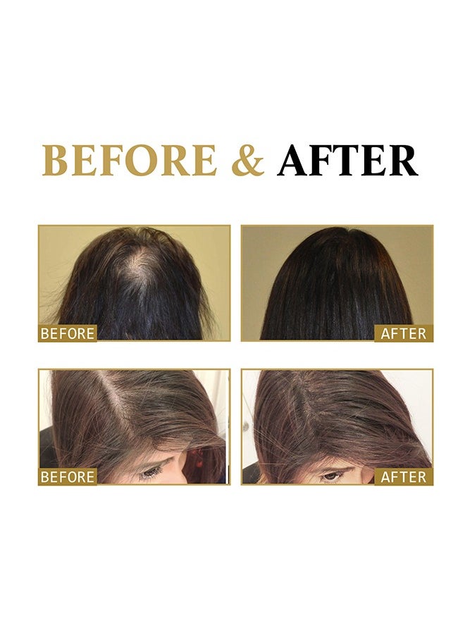 West&Month Hair Boost Darken Strengthen Essence Promote Hair Circulation Visibly Stronger And More Abundant Looking Hair,Scalp Massage Roller For Hair Loss Treatments, Aids against Hair-thining, Hair Regrowth Tr  - Image 4