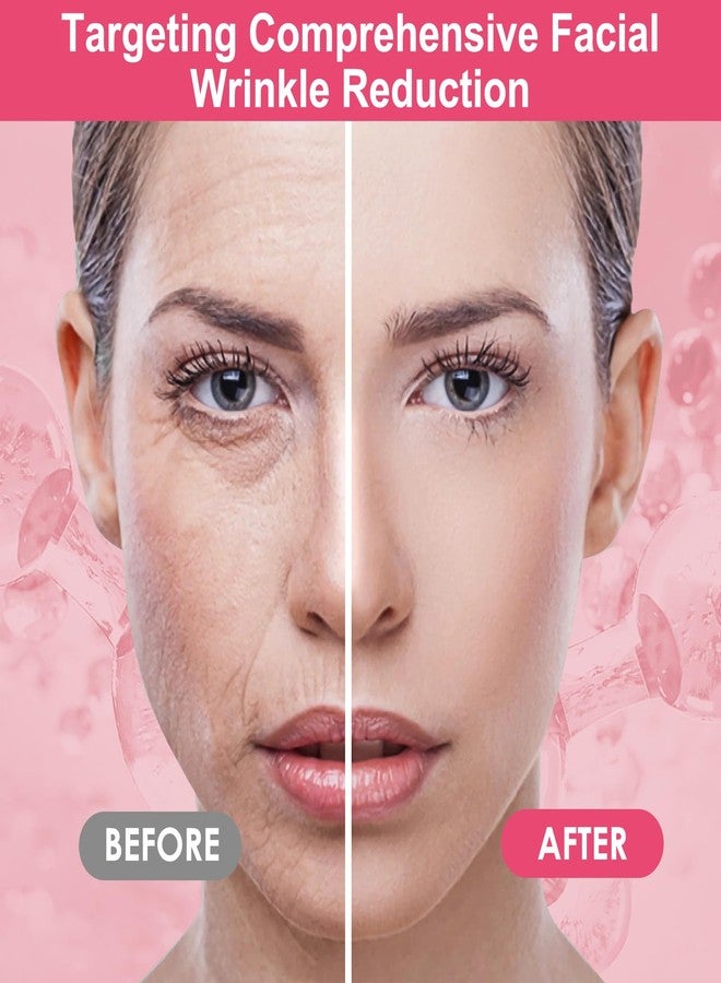 TEAWOO 16 PCS Reusable Face Wrinkle Patches Kit | Face Patches for Wrinkles Overnight | Anti Wrinkle Patches | Facial Patches for Wrinkles | Forehead Wrinkle Patches | Face Lift Tape - Image 3