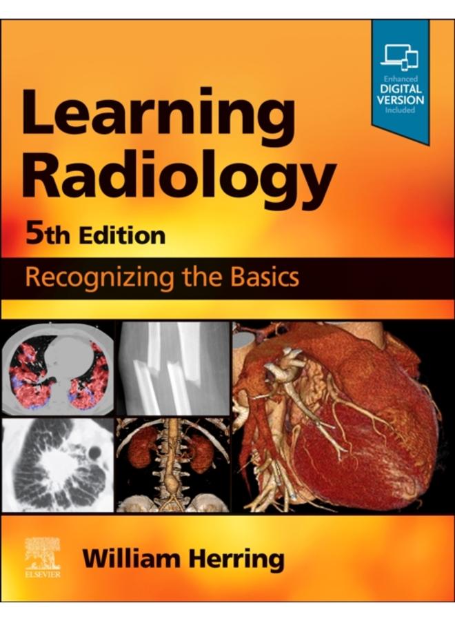 Learning Radiology : Recognizing the Basics