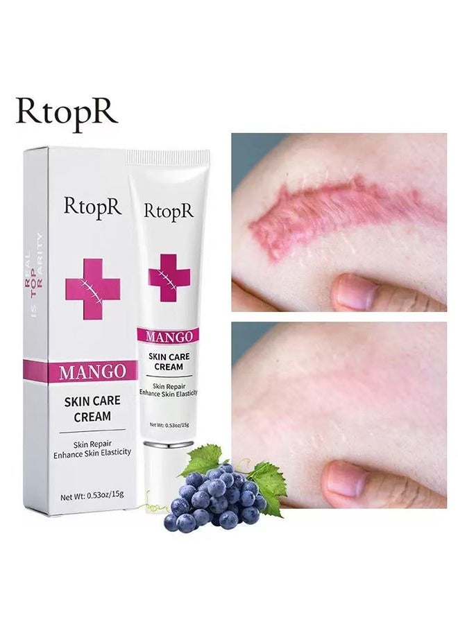 RtopR Scar Repair Cream -  Skin Repair Removal Creams Treatment Stretch Marks Acne Surgical Care 15g - Image 1