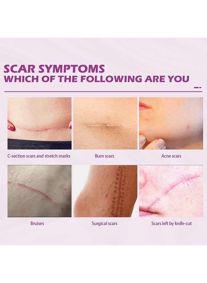 RtopR Scar Repair Cream -  Skin Repair Removal Creams Treatment Stretch Marks Acne Surgical Care 15g - Image 3