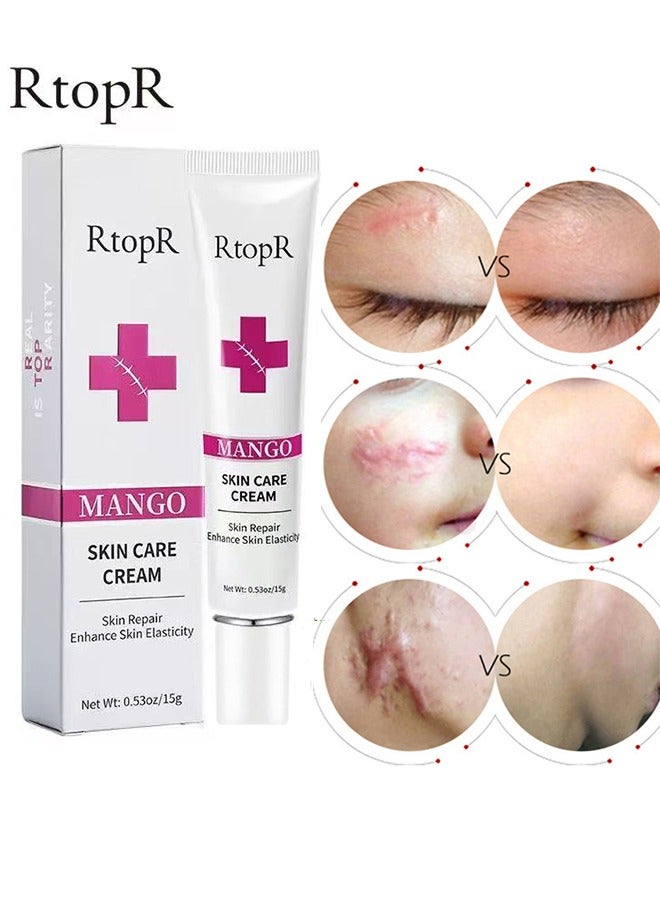 RtopR Scar Repair Cream -  Skin Repair Removal Creams Treatment Stretch Marks Acne Surgical Care 15g - Image 5