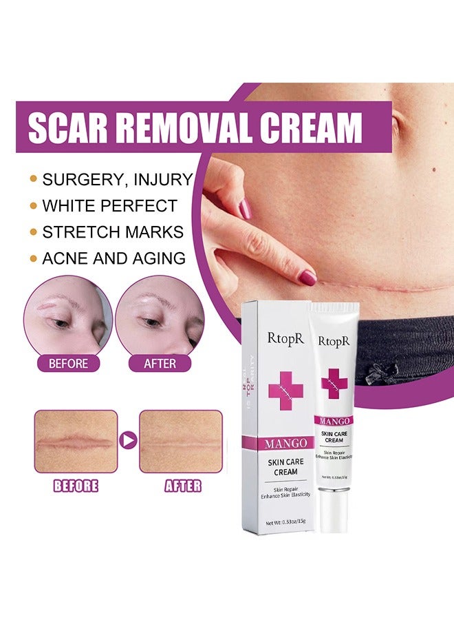 RtopR Scar Repair Cream -  Skin Repair Removal Creams Treatment Stretch Marks Acne Surgical Care 15g - Image 2