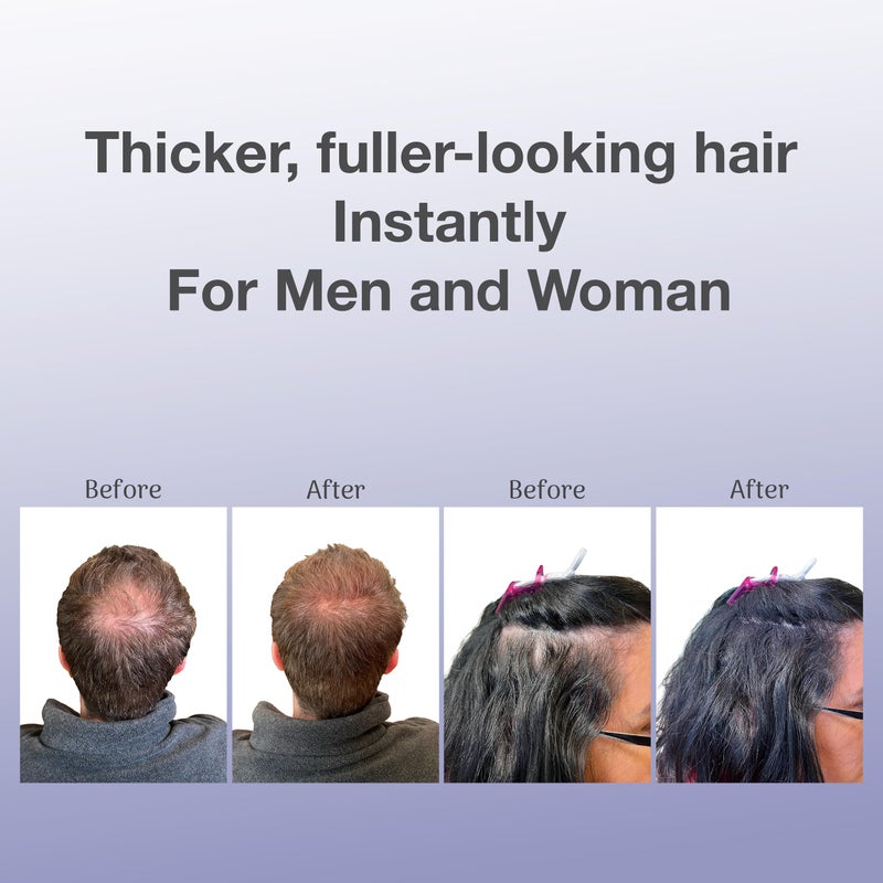 BosleyMD Professional Strength Hair Thickening Fibers, Dark Brown, 0.42 Ounce (Pack of 1) - Image 4