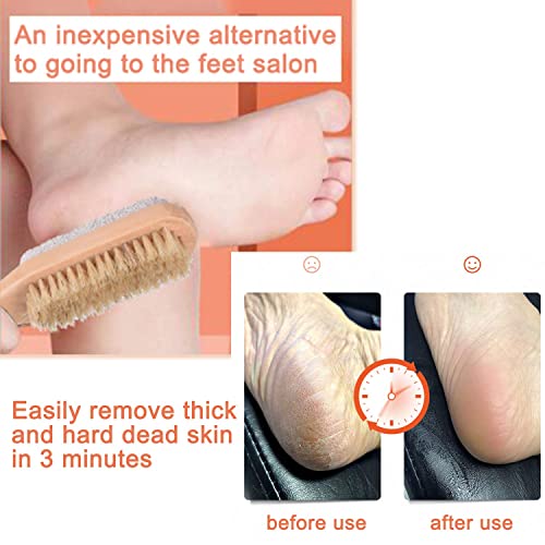 Amzgear Natural Pumice Stone Combo foot Brush, Body Exfoliating Double Side Soft Bristle Wood Brush, Suitable for Pedicure Brush Kit Tool for Cleanse, Scrub & File Dead Skin Callus Remover (Pack of 2) - Image 5