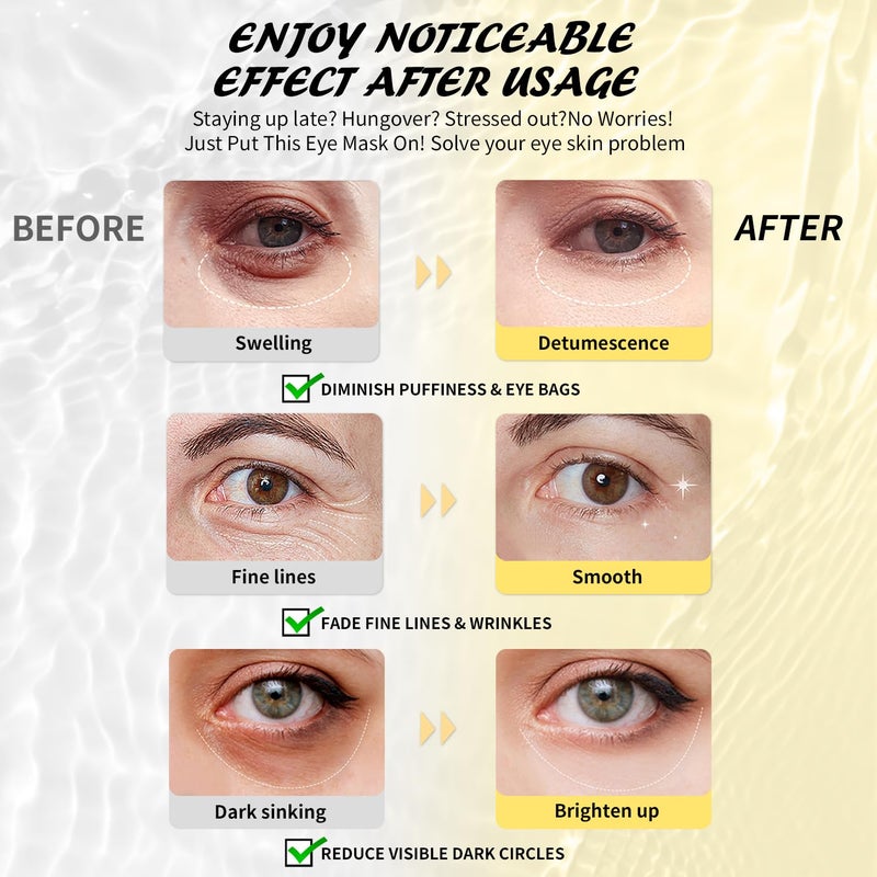 Maskiss Under Eye Patches 25 Pairs Caffeine Eye Masks for Dark Circles Puffy Eyes Undereye Bags Collagen Eye Patches for Wrinkles and Puffiness Skin Care Gift for Her - Image 3