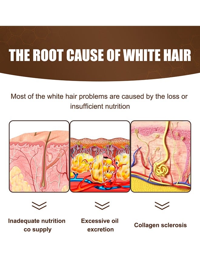 Jaysuing Anti White Hair Essence, Dark Anti Graying Hair Serum for Men and Women, Nutrient Natural Darkening, Promoting Healthier and Thicker Hair 30ml - Image 4