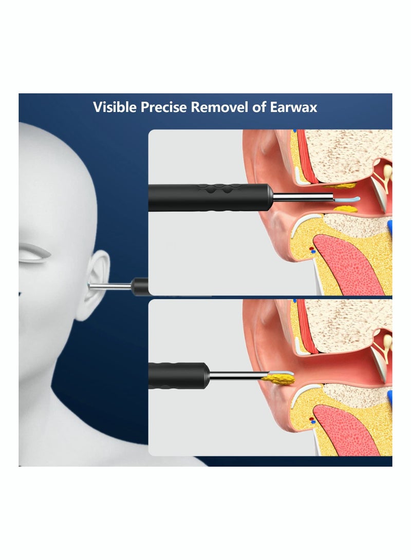 ASIV Ear Wax Removal Kit - Visible Ear Wax Remover with Camera, Otoscope with Light, Ear Cleaner with 8 Ear Pickers + 6 Ear Scoops, Wireless Ear Wax Remover for iOS, Android Phones - Image 5