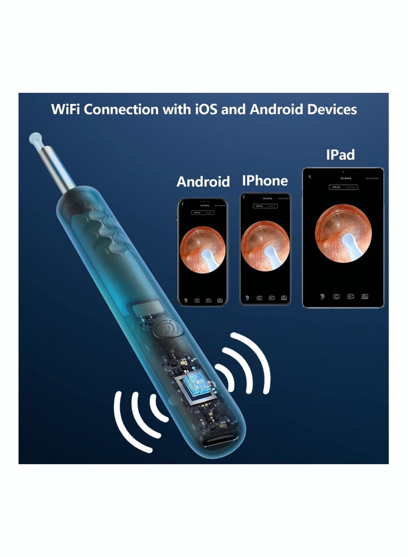 ASIV Ear Wax Removal Kit - Visible Ear Wax Remover with Camera, Otoscope with Light, Ear Cleaner with 8 Ear Pickers + 6 Ear Scoops, Wireless Ear Wax Remover for iOS, Android Phones - Image 4