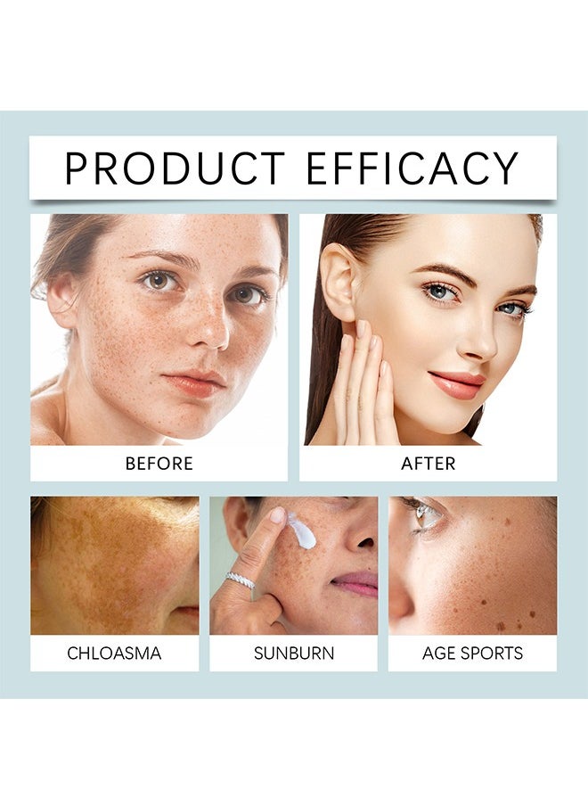 Hoygi - Dark Spot Remove,Brightening Freckle Cream,Ultimate Brightening & Freckle Removal Cream - Powerful Whitening Cream for Age Spots, Dark Spots, and Skin Pigmentation | Fade Freckles, Chloasma, and Sun Spots for Even Skin Tone-20g - Image 1
