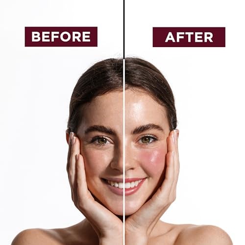 Orgatre PH Lip & Cheek Oil | Lip tint gloss | Color Changing Tint for Women | With Jojoba & Olive Oil, Vitamin E | Non-Sticky, Hydrating & Long-Lasting Glow | 2-in-1 Lip & Cheek Tint for Soft Pink Look | 6.5ml - Image 2
