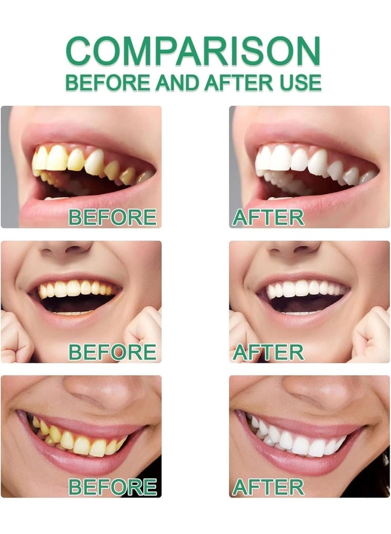 Bodyaccel Niacinamide Whitening Toothpaste, Niacinamide Toothpaste, Bodyaccel Toothpastes, Tripel Whitening Niacinamides Whitenings Toothpastes (100g With Toothbrush)