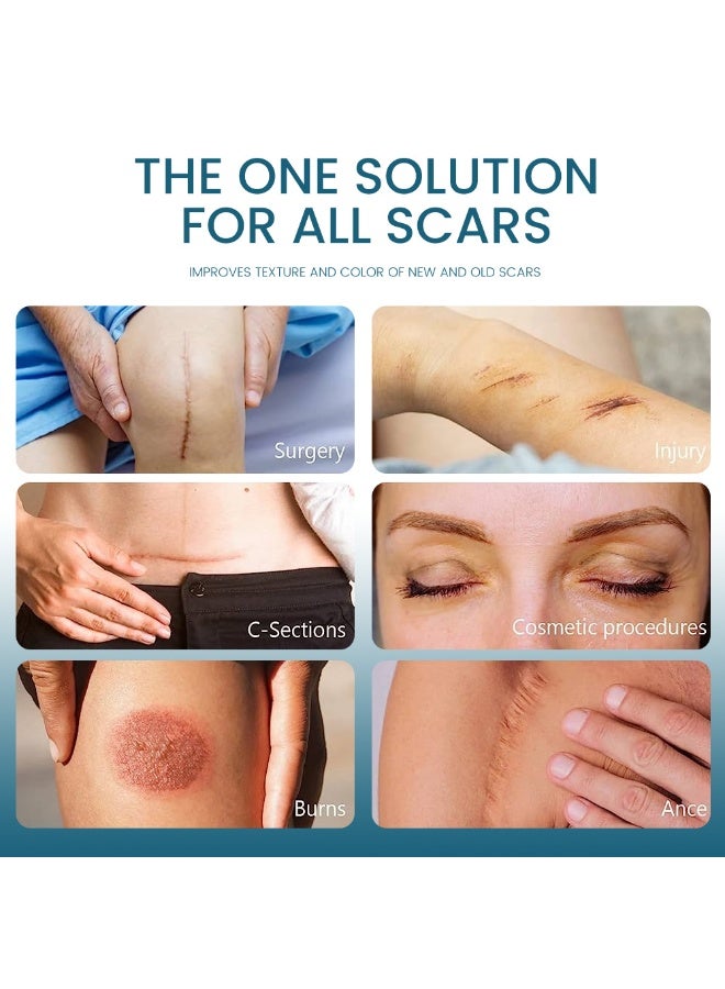 سوميفون جل تفتيح الندبات، كريم تفتيح الندبات، كريم حروق البشرة، كريم للعناية بالبشرة، عبوة واحدة - Image 3
