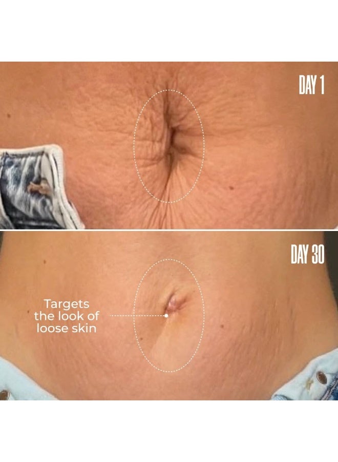 MAELYS B-Flat Cellulite Stretch Marks Firming Cream - Image 4