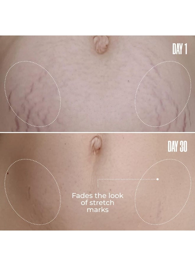 MAELYS B-Flat Cellulite Stretch Marks Firming Cream - Image 3