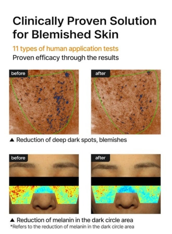 Pore celimax - Image 3