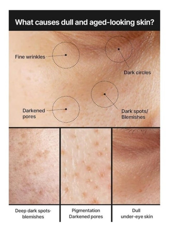 Pore celimax - Image 4