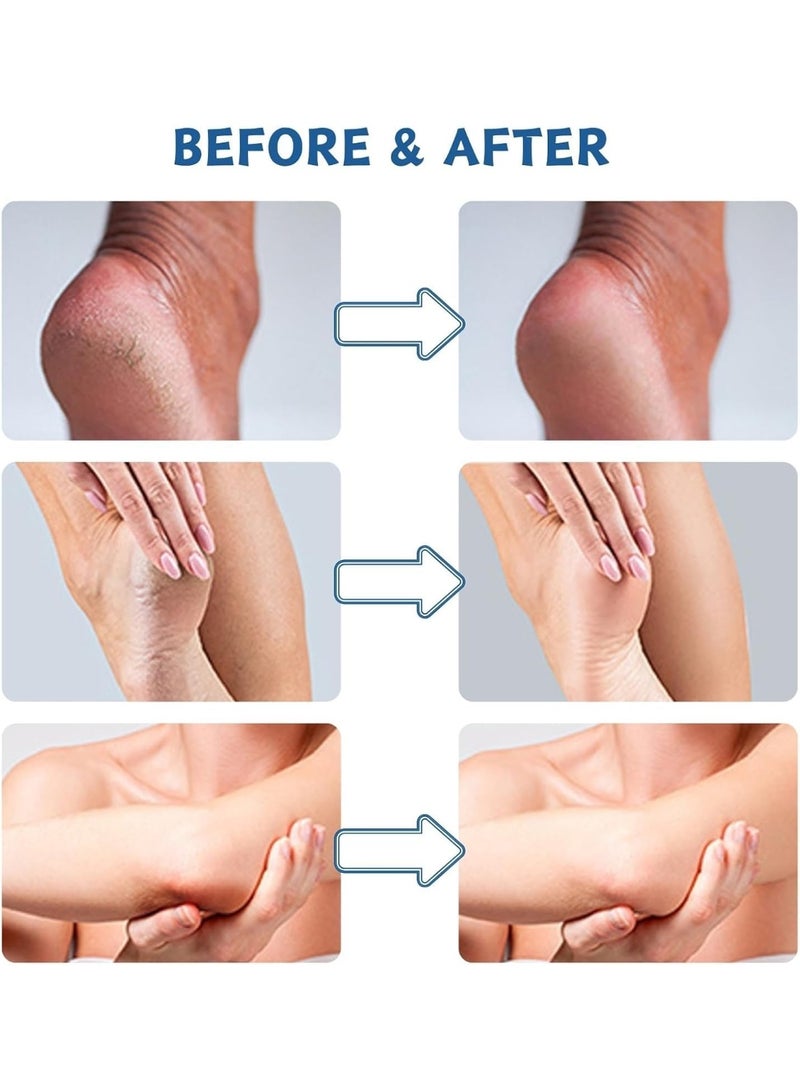 GraGra Urea Cream, 2 Pcs Urea Foot Cream, Premium Urea Foot Cream, Skin Care Moisturizer, For Feet, Hands, Heels, Elbows, Knees and More, Deep Moisturizes, Callus Remover and Soften - Image 2