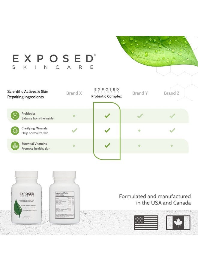 Exposed Skin Care Probiotic Complex Skin Balancing Dietary Supplements Assist Your Skin Care Routine With A Healthy Immune System 60 Ct Capsules - Image 5