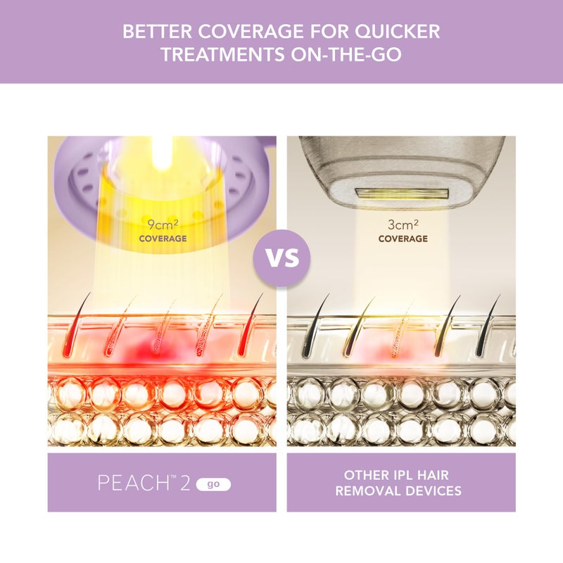 FOREO Peach 2 go IPL Hair Removal Device - Travel-Friendly Permanent Removal - Laser Treatment for Body & Face - Painless & Skin Cooling - Silicone Shield - Customizable - Lavander - Image 3