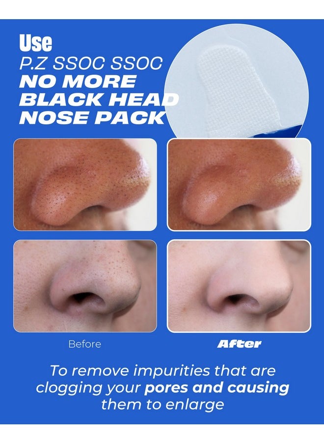One-day's you - P.Z Ssoc Ssoc No More Blackhead Nose Strips Sebum & Pore Care Hypoallergenic Korean Nose Mask Blackhead Remover Clogged Pore Tightening Skin Care W/Centella Asiatica (0.07 Oz 5 Ea) - Image 1