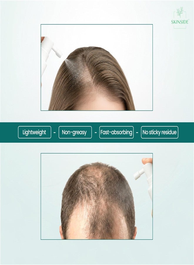 SKINSIDE Hair Growth Serum Concentrate | 25% Actives | Redensyl, Anagain, Procapil, Bicapil, Capixyl, Rosemary, Rice Water, Caffeine | Hair Fall Control & Stronger Roots, 30ml - Image 4
