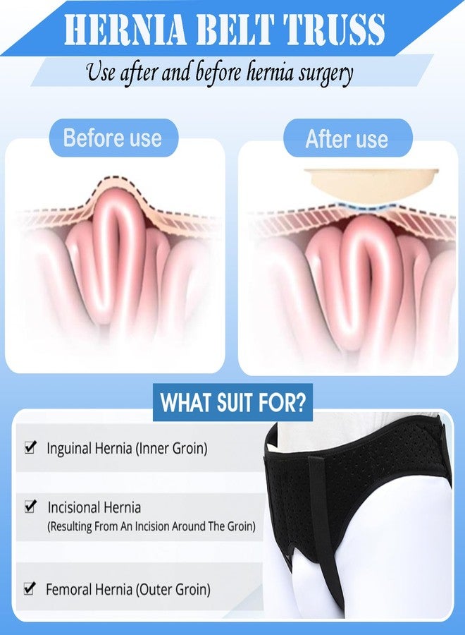 AUSTYLCO Hernia Belt for Men for Women,Adjustable Waist Strap with 2 Removable Compression Pads,Hernia Support Truss for Single/Double Inguinal - Image 2