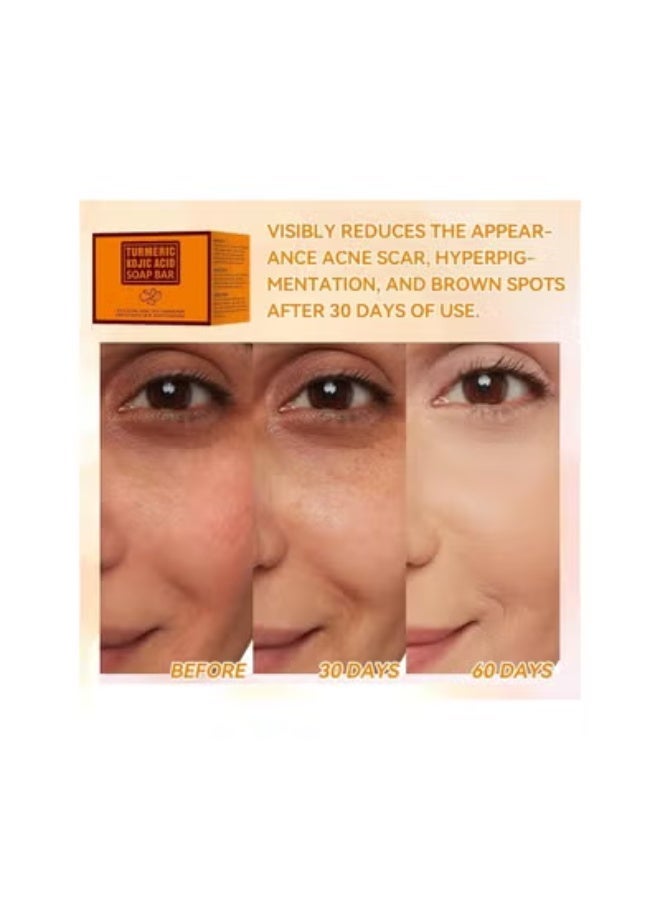 كلاراكو مجموعة شمع رول أون مع شاشة رقمية LED، مجموعة إزالة الشعر بالشمع للنساء، شمع إزالة الشعر، بكرة شمع لإزالة الشعر مع خراطيش شمع العسل، 100 قطعة من شرائح الشمع، 10 قطع من المناديل، بكرة شمع للإبط والساق والذراع - Image 2