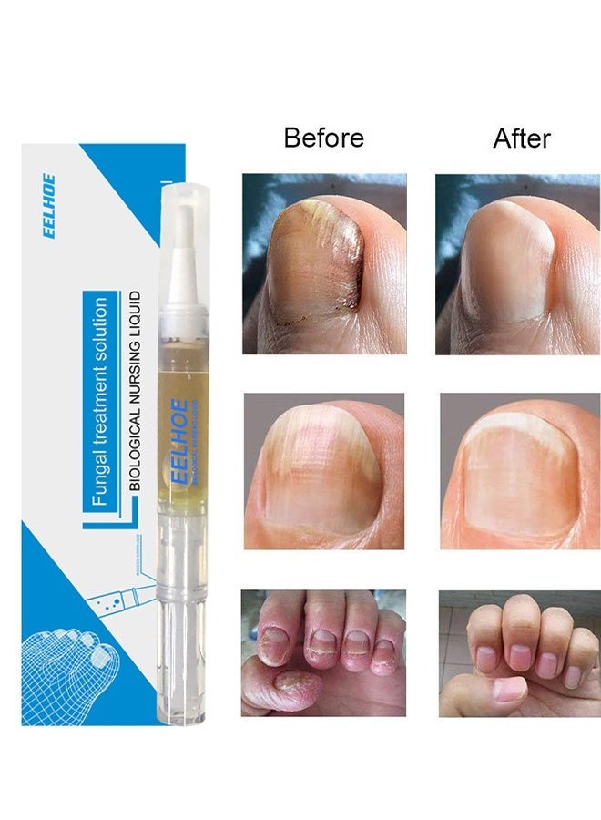 إيلهو حل علاج الفطريات، قلم إصلاح الفطريات للأظافر، سائل رعاية الفطريات للأظافر، للعناية اليومية باليدين والقدميين، لوشن للأظافر، تليين الأظافر السميكة، قلم إصلاح الأظافر الفطرية للأظافر التالفة، 3 مل. - Image 5