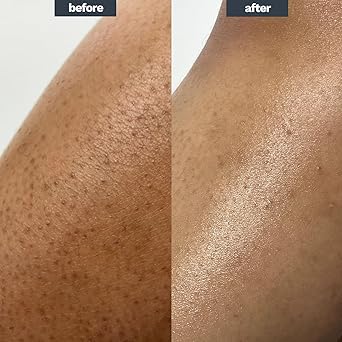 AMELIORATE ميتي تقشير الجسم من أميليوريت، مختبر جلدياً - Image 4