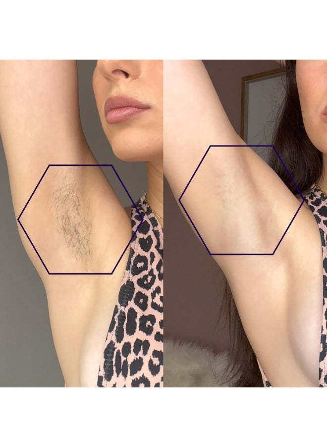 Walpck BEAUTY - Laser IPL Hair Removal Device with Ice Cooling Care Function, 50°F CoolMax Technology, 999,999 Flashes, 3 in 1 with Skin Sensor for Nearly Painless, Permanent Hair Removal for Women and Men - Image 5