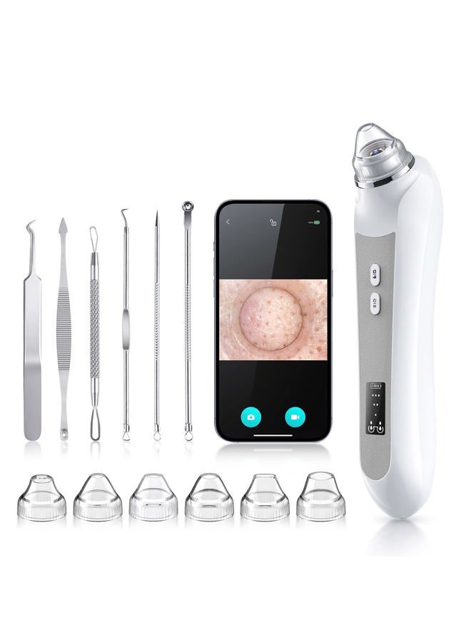 TTozka Blackhead Remover Vacuum, Black Head Remover for Face with Canera, Pore Vacuum for Men and Women, USB Interface Type Blackhead Remover Tools, Equipped with 6 Suction Heads and 3 Gears - Image 1